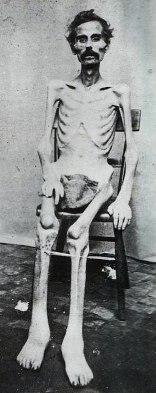 Civil War prisoner-of-war.jpg